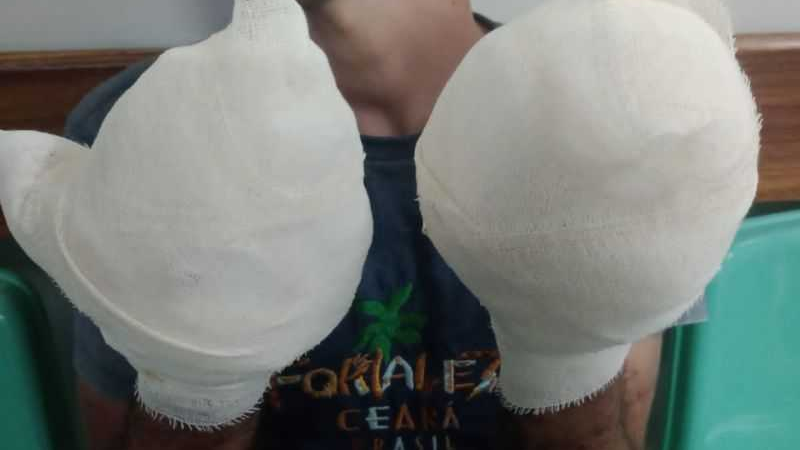 Homem é acusado de roubo, tem os dedos cortados e mostrados em vídeo