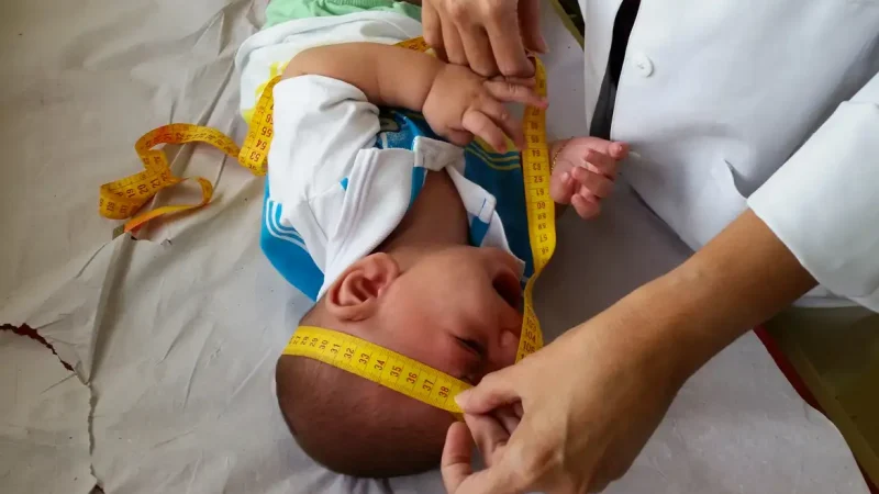 INSS pagará indenização de R$ 60 mil a crianças vítimas de zika