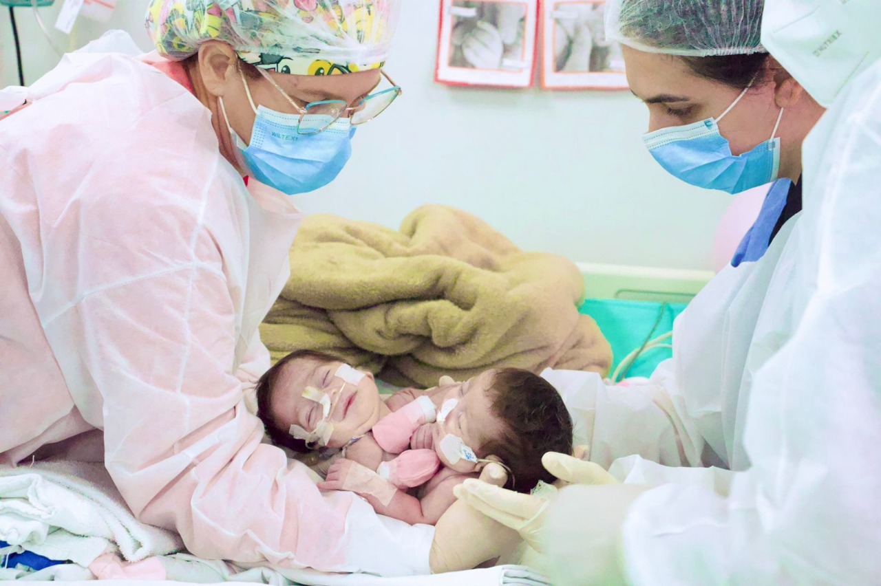 Cirurgia de separação de gêmeas siamesas nascidas no Amazonas é realizada com sucesso em Goiânia