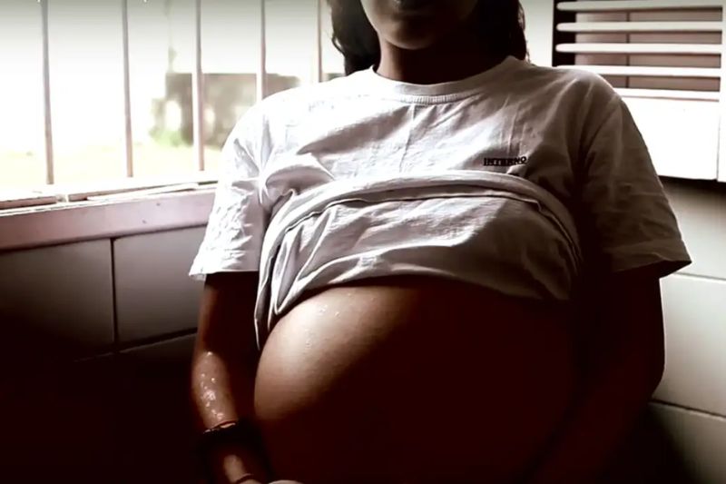 SUS oferecerá implante às mulheres para prevenir gravidez