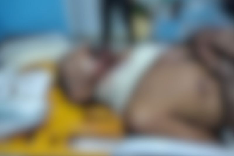 Idoso reage a assalto em casa e é brutalmente atacado pelos bandidos no interior do Amazonas