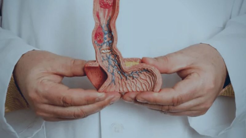 Higiene íntima precária pode causar câncer de pênis, alerta urologista