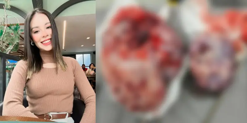 Jovem luta contra câncer agressivo e pede ajuda urgente para tratamento em Manaus