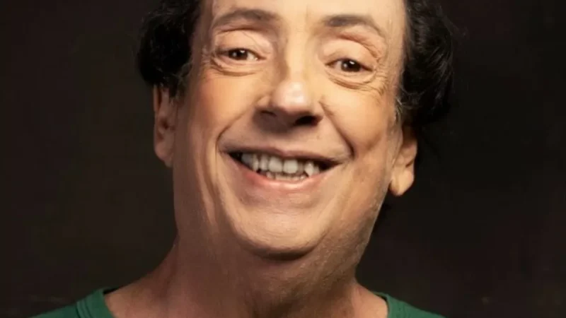 Marcos Oliveira passará por cirugia