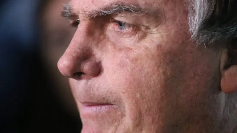 Com crise persistente de soluços, Bolsonaro faz nova cirurgia