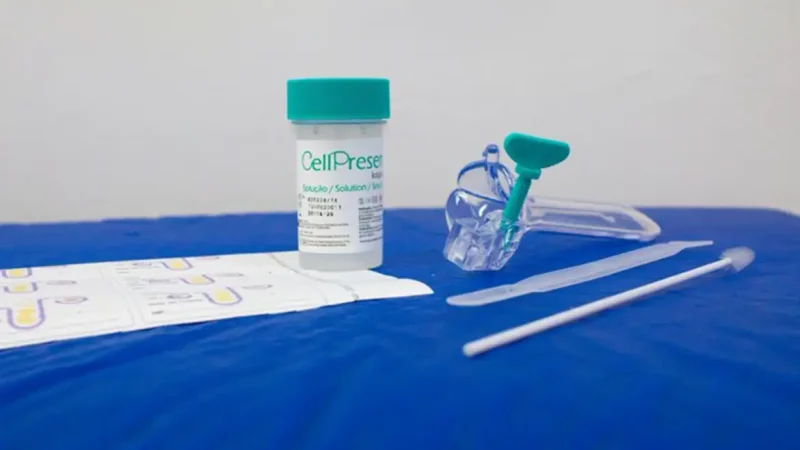 Guia orienta sobre mudança no rastreamento do câncer de colo do útero