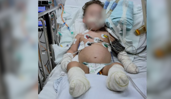 Homem é preso ao gastar mais de R$ 100 mil de doações para filho amputado