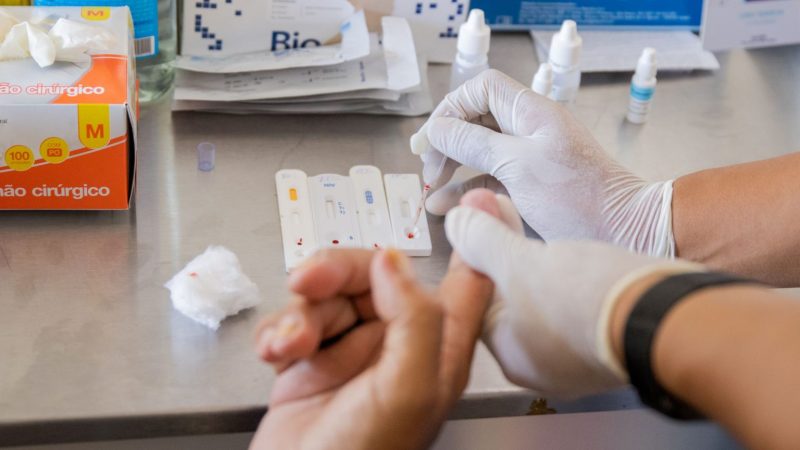 Prefeitura de Manaus fortalece estratégia para reduzir adoecimento e morte por HIV/Aids