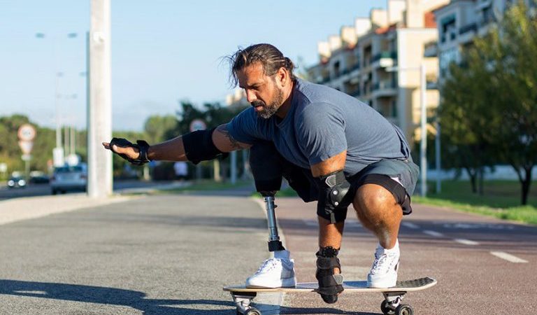 Nova lei cria data para destacar importância da inclusão de pessoas que não têm partes do corpo