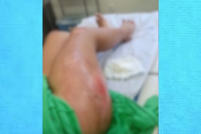 Homem usa caminhão para tentar matar ex-esposa atropelada no Amazonas