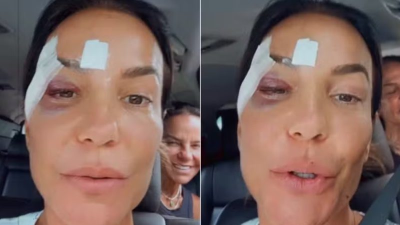 Ivete Sangalo tem alta após desmaio vasovagal. Entenda o que é!