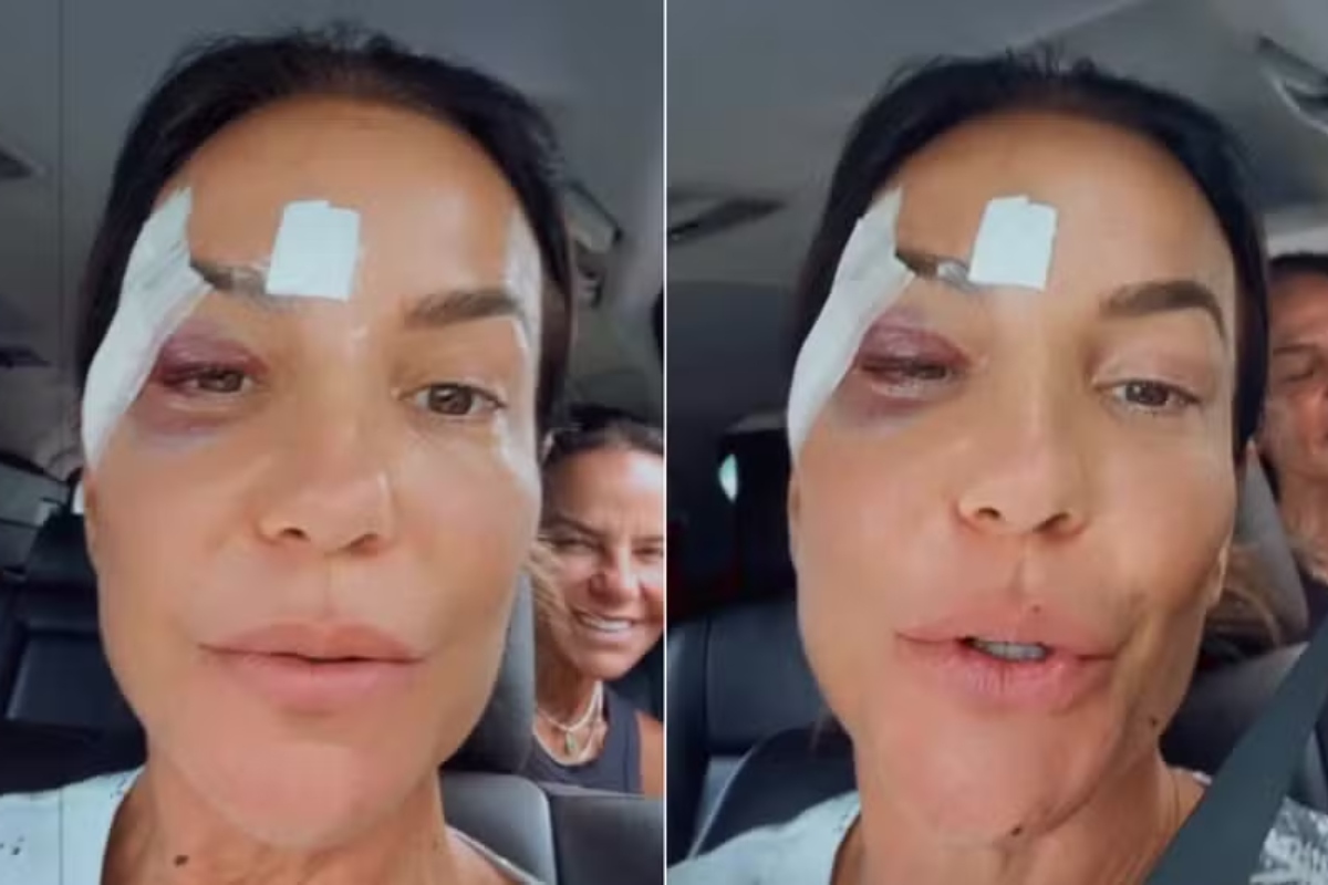 Ivete Sangalo tem alta após desmaio vasovagal. Entenda o que é!