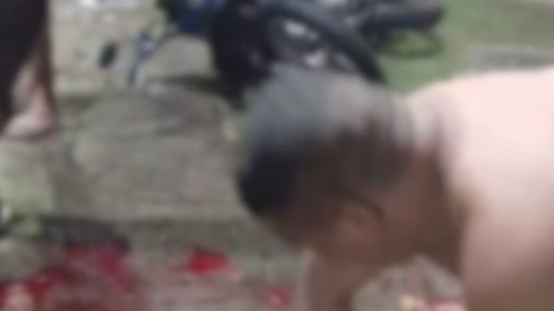 Motociclista tem a perna dilacerada ao bater em carro em avenida de Manaus