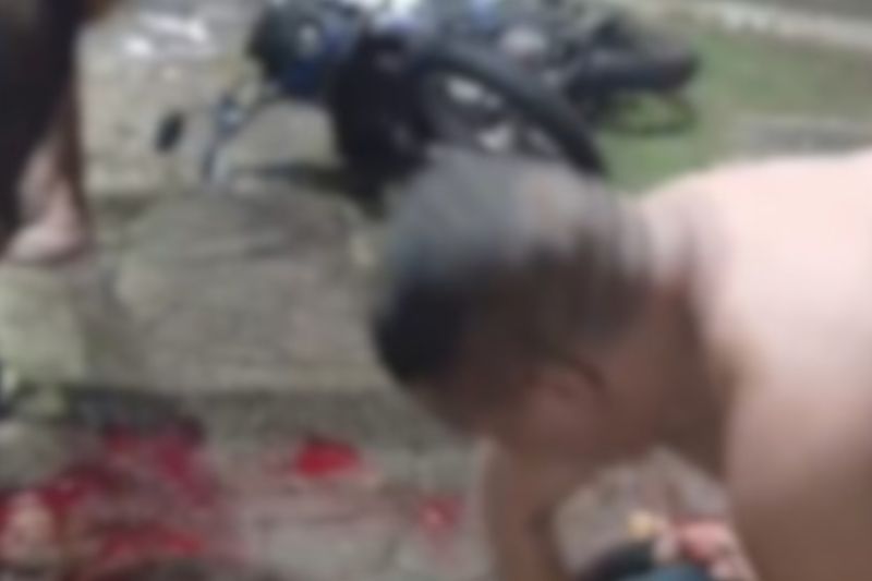 Motociclista tem a perna dilacerada ao bater em carro em avenida de Manaus