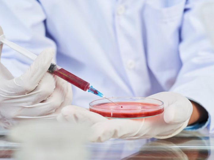 Junho Laranja: saiba por que é importante avaliar a saúde do sangue e como fazer