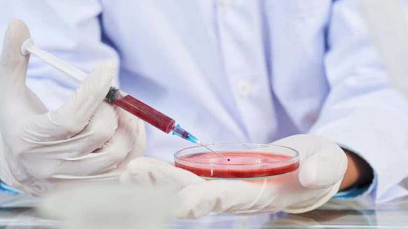 Junho Laranja: saiba por que é importante avaliar a saúde do sangue e como fazer