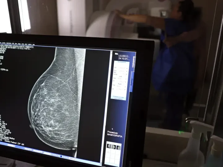 Plano de saúde terá que cobrir mamografia digital para todas as idades