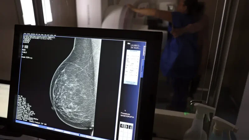 Plano de saúde terá que cobrir mamografia digital para todas as idades